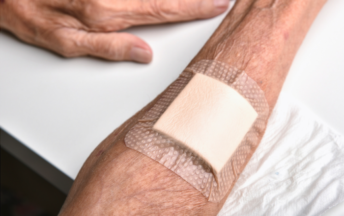 wound on arm dressed professionally by community nurses