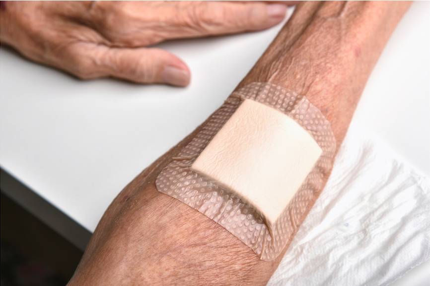 wound on arm dressed professionally by community nurses